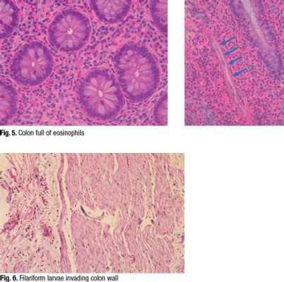  Quinella: Un Parasito Microscópico que Habita en los Tejidos de su Anfitrión