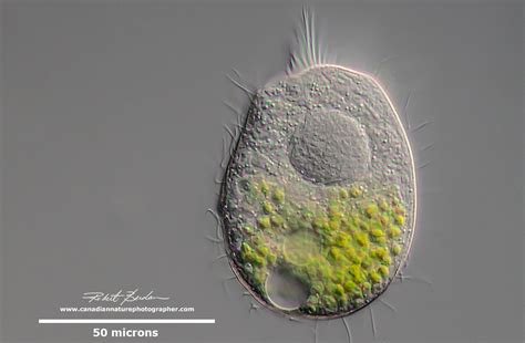  Qué es un Question mark Ciliate y por qué deberías conocer a este diminuto pero asombroso depredador acuático?