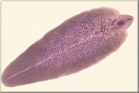  Quinqueserialis: ¡Un gusano trematodo que ama bailar!